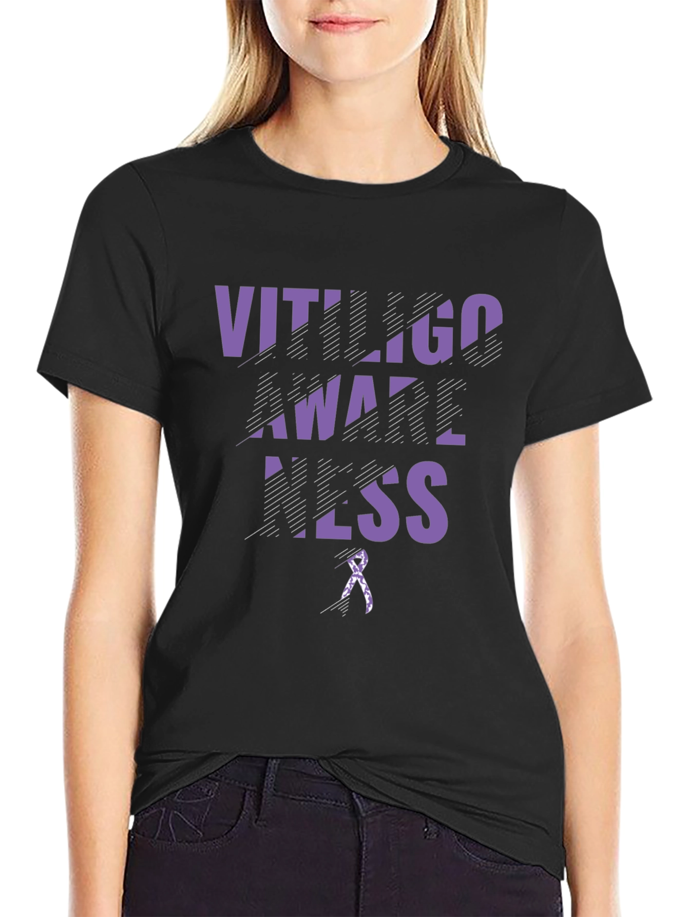 Vitiligo Awareness Black T-Shirt