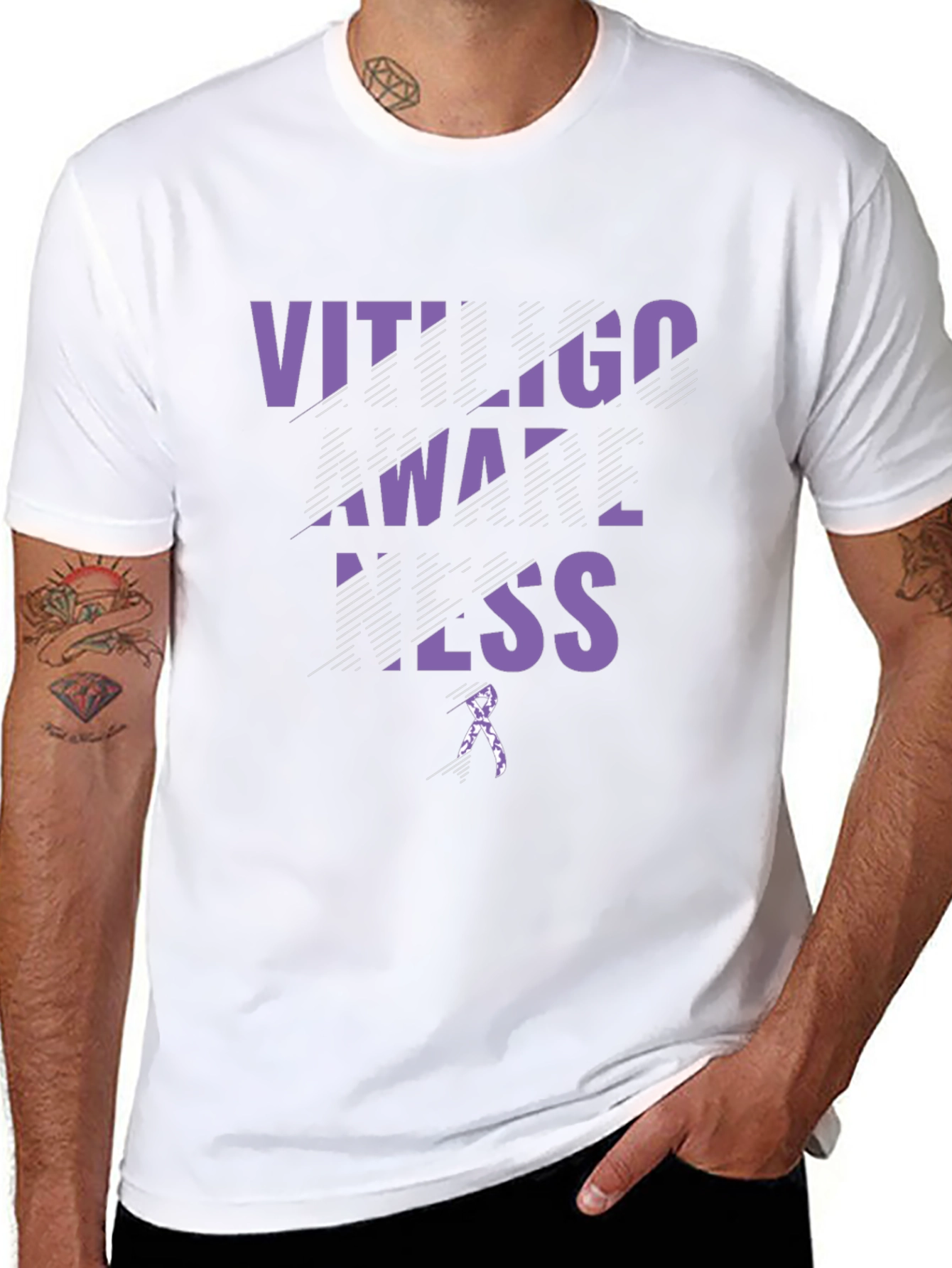Vitiligo Awareness Black T-Shirt