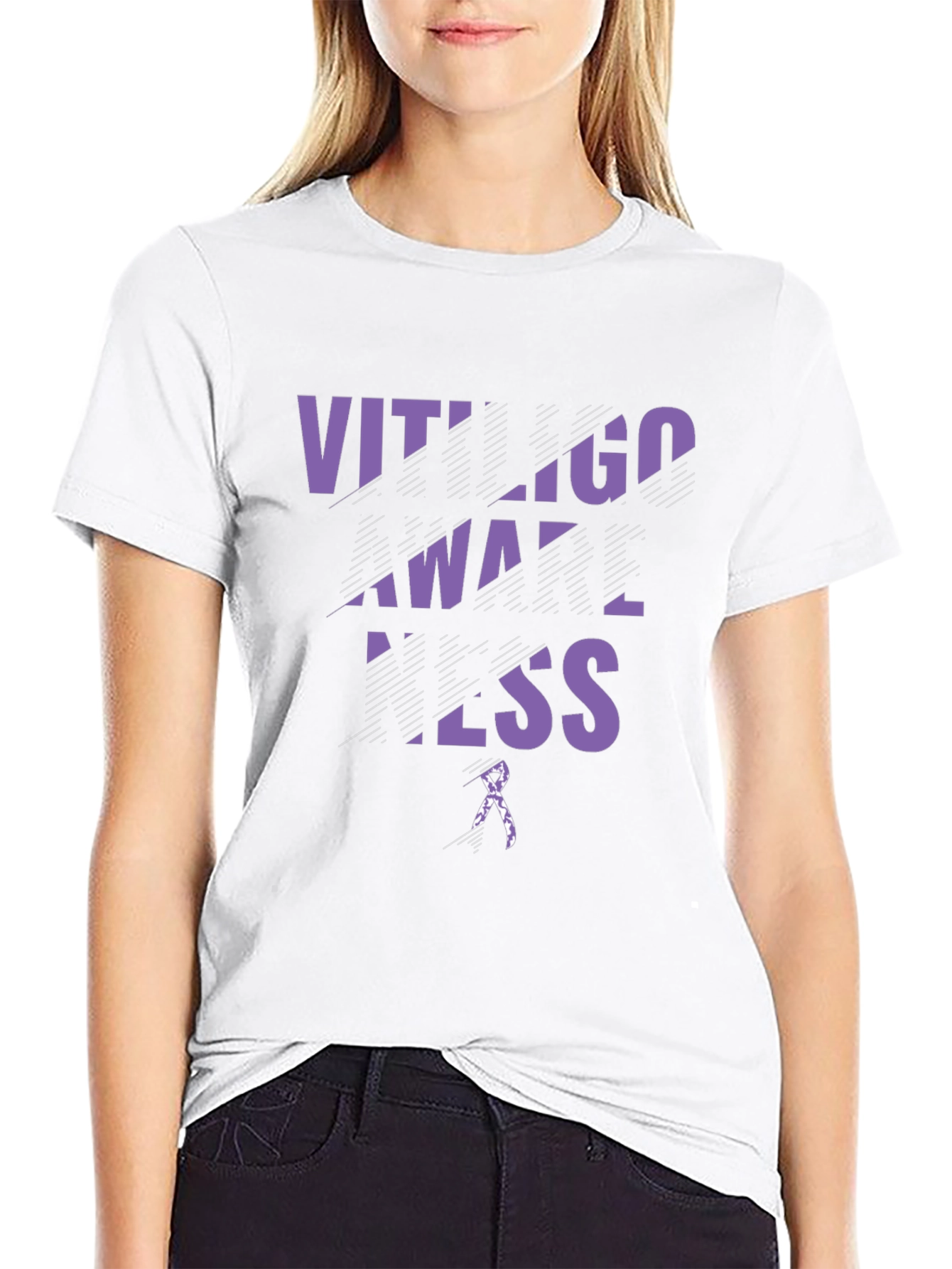 Vitiligo Awareness Black T-Shirt